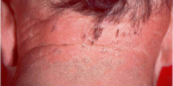 Article teaser image