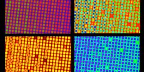 Article teaser image