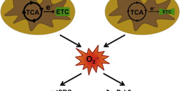 Article teaser image