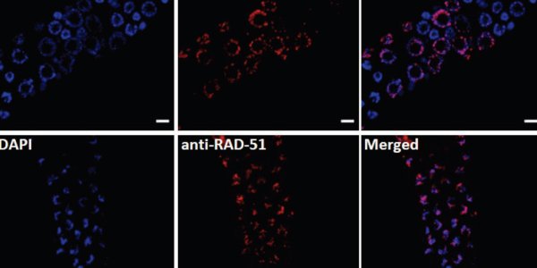 In Flies, NAD+ Supplements Slow Werner Syndrome Early Aging Syndrome