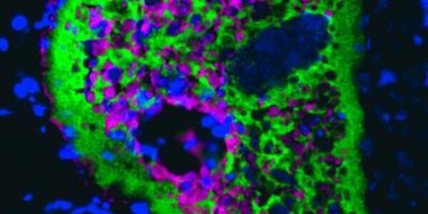 Article teaser image