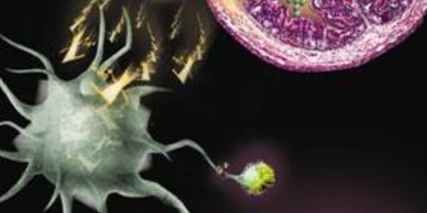 Article teaser image