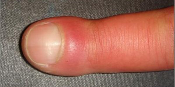 Article teaser image