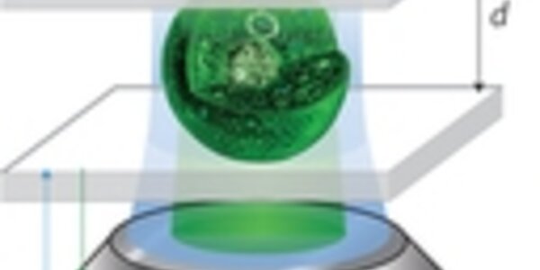 Article teaser image