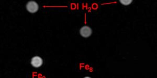 Article teaser image