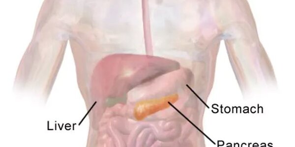 Article teaser image