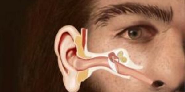 Article teaser image