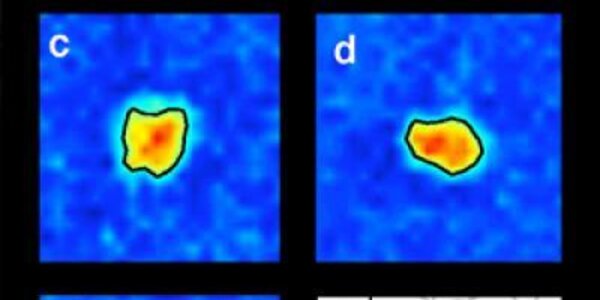 Article teaser image