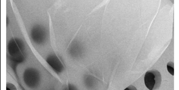 Article teaser image