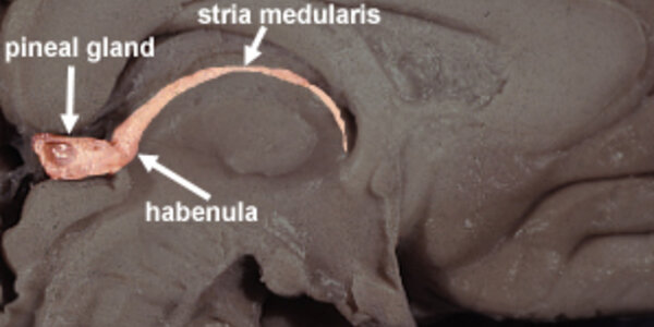 Article teaser image