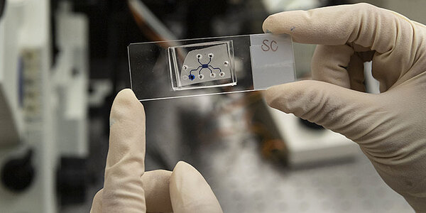 Article teaser image