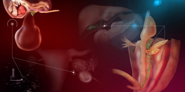 Article teaser image