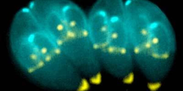 Article teaser image