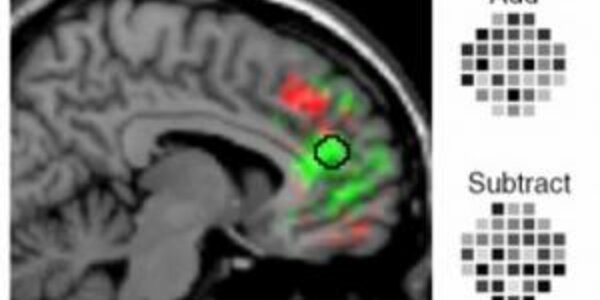 Article teaser image