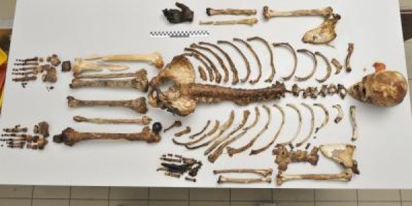 Investigative Genetics: Forensic Science Can Discover Hair, Eye Color From Medieval Remains