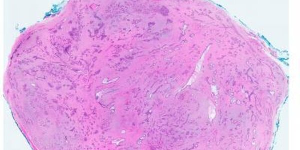 Article teaser image