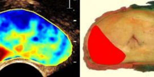 Article teaser image