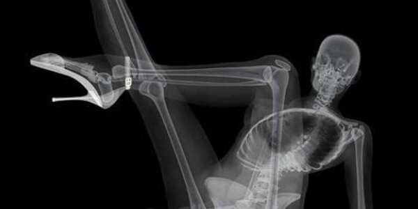 Article teaser image