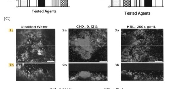 Article teaser image