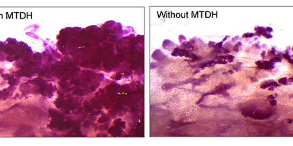 Article teaser image