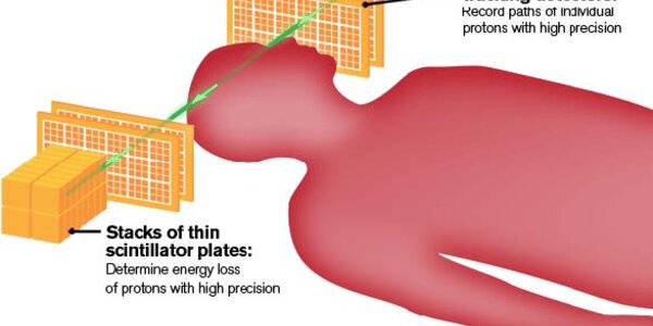 Article teaser image