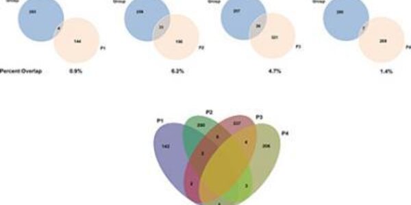 Article teaser image