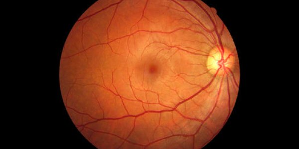 Your Eyes Are Wired Backwards: Here's Why