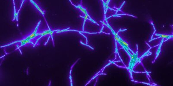 Article teaser image