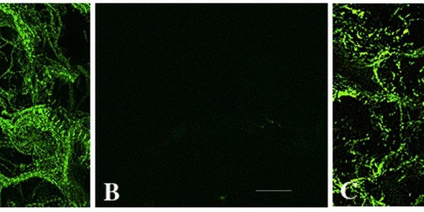Invention Restores Cardiac Muscle Function From Heart Attacks, Defects