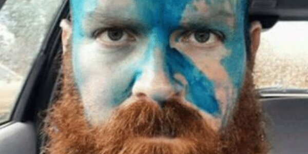 Article teaser image