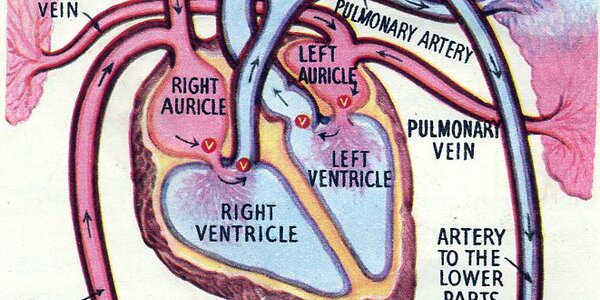 Article teaser image
