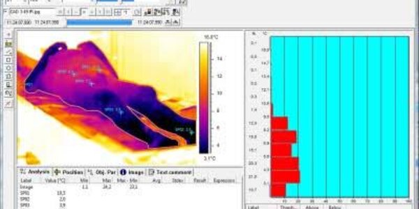 Article teaser image