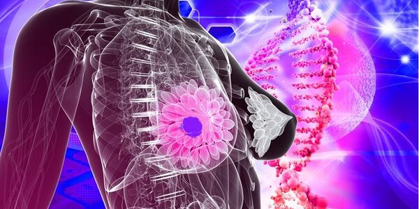 Article teaser image