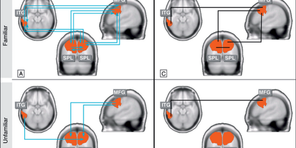 Article teaser image