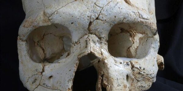 Article teaser image