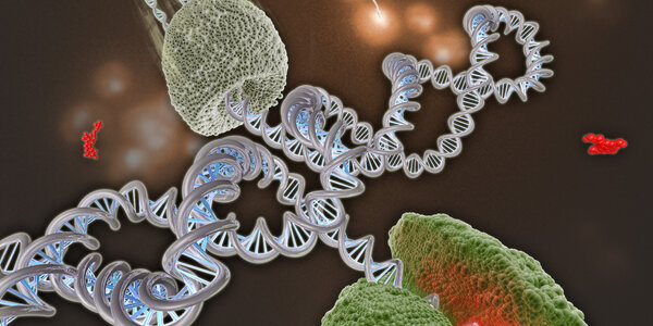 Article teaser image