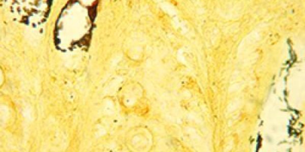 Article teaser image