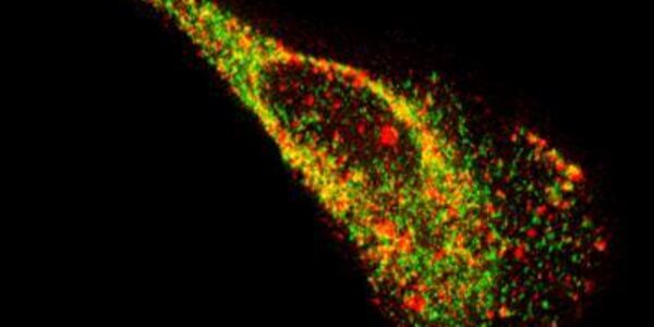 Article teaser image