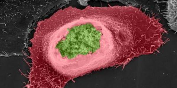 Article teaser image