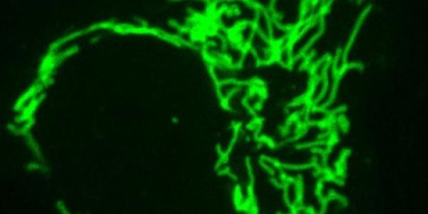 So Long Antibodies, Welcome Frankenbody