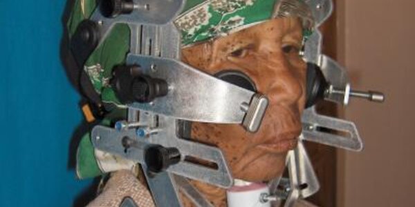 Article teaser image