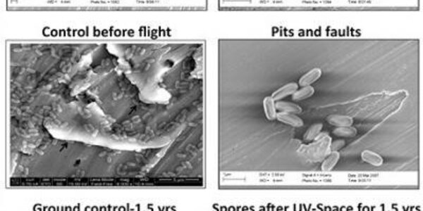 Article teaser image