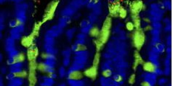 Of Microbes And Milk Allergies