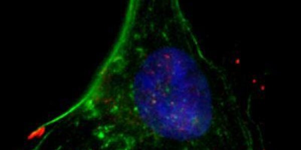 Article teaser image