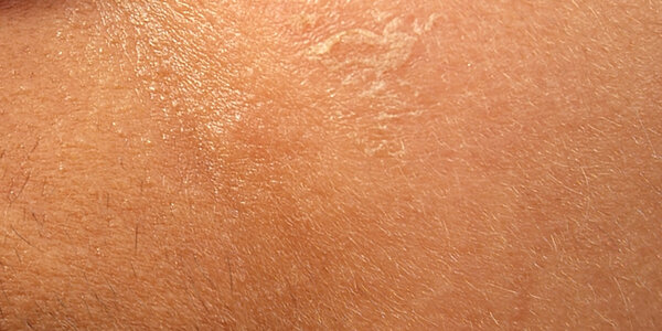 Article teaser image