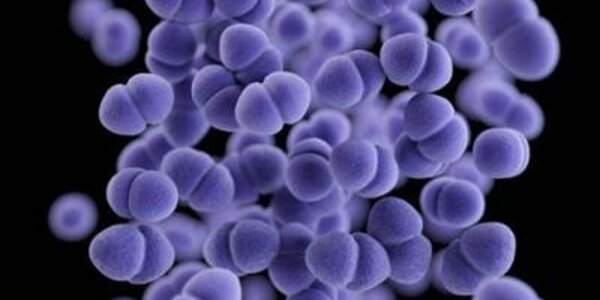 Article teaser image