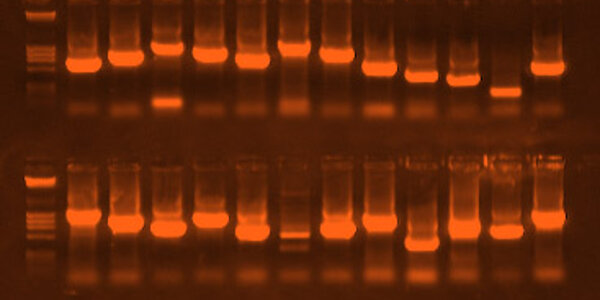 Article teaser image