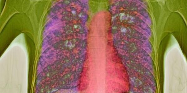 Article teaser image