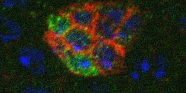 Article teaser image