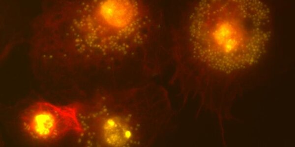 Article teaser image